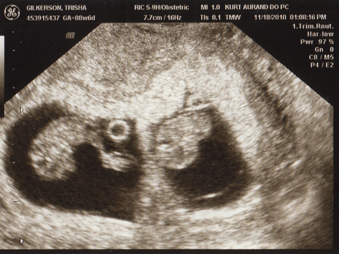 The ultrasound tech said, "There's two." Two what? "Two babies." We're having two babies. In a million years we never expected to be parents of twins. https://www.intoxicatedonlife.com/2012/04/27/were-having-two-babies/